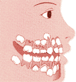 ６歳頃の乳歯・永久歯の位置関係